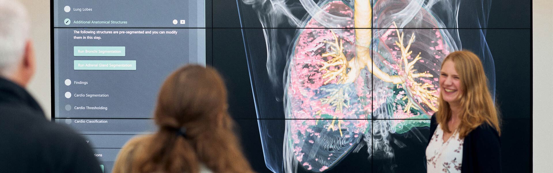 Wissenschaftler:innen des Frauenhofer MEVIS betrachten den Scan einer Lunge