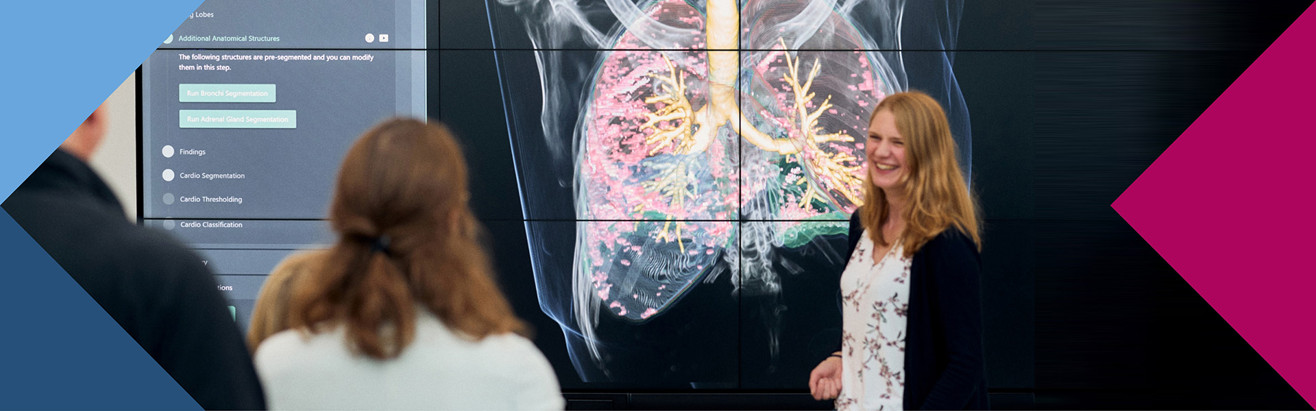 Wissenschaftler:innen des Frauenhofer MEVIS betrachten den Scan einer Lunge